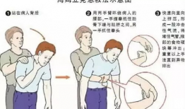 海姆立克急救法视频,关键时刻的救命技能详解
